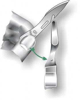 Preview: Skalpellklingen OR System 100 Stück -Wählbar Größe 1 oder 2 ! MHD 2030