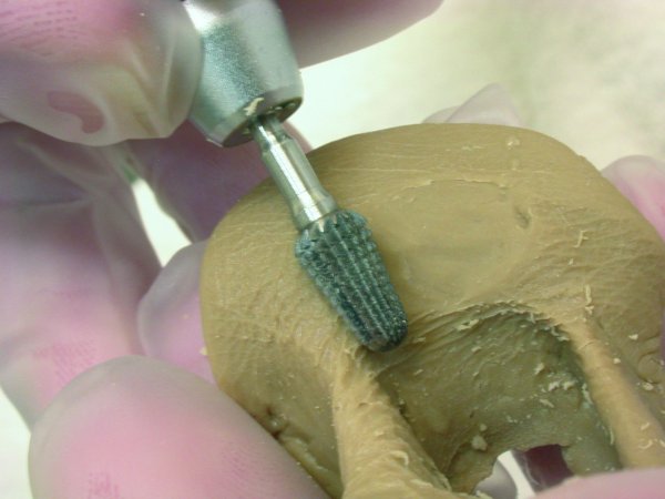 Hartmetall-Fräser Bearbeitung stark verdickter Nägel, Hyperkeratosen,Gel, Acryl, Orthesenkunststoffe